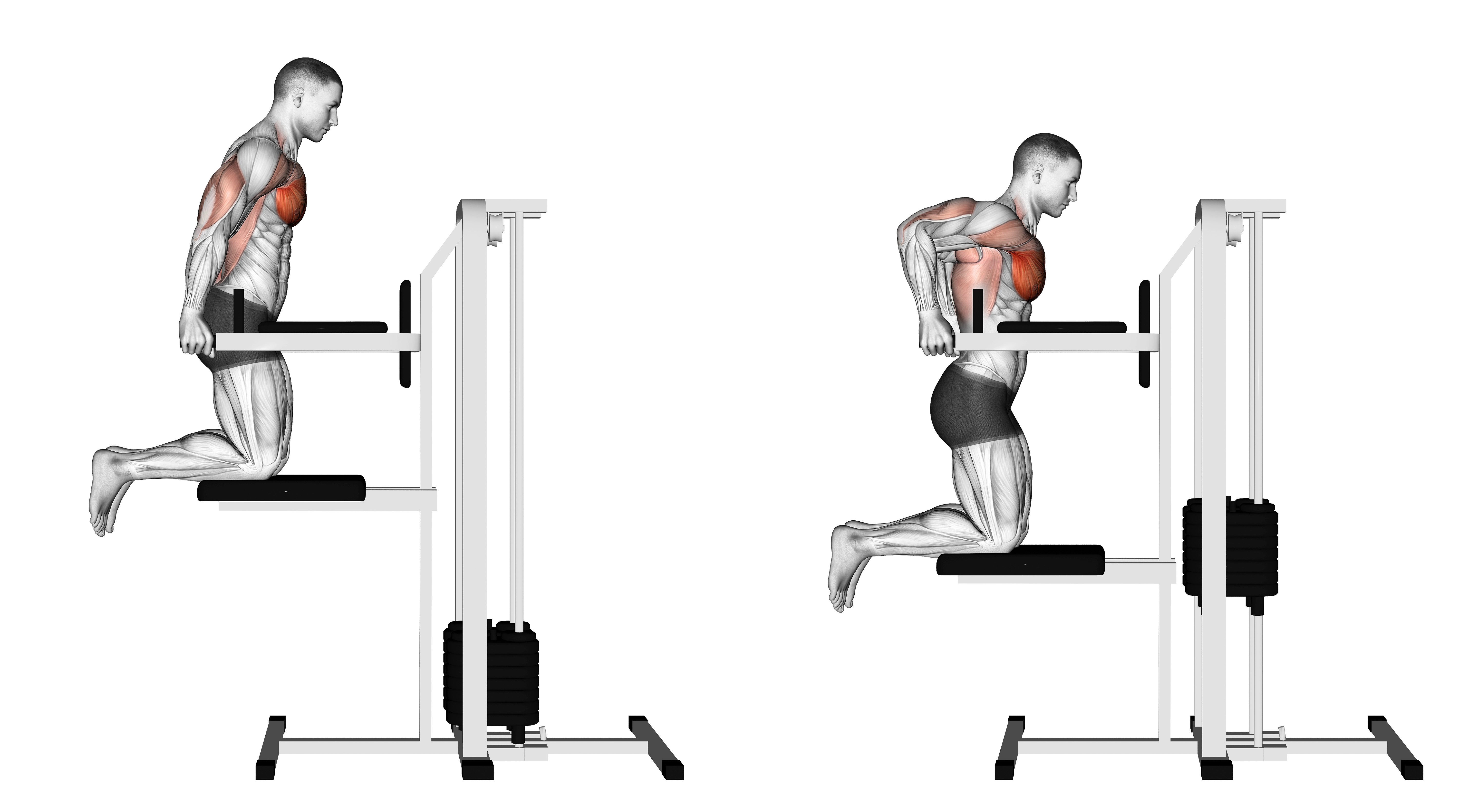 Assisted Chest Dip Kneeling 