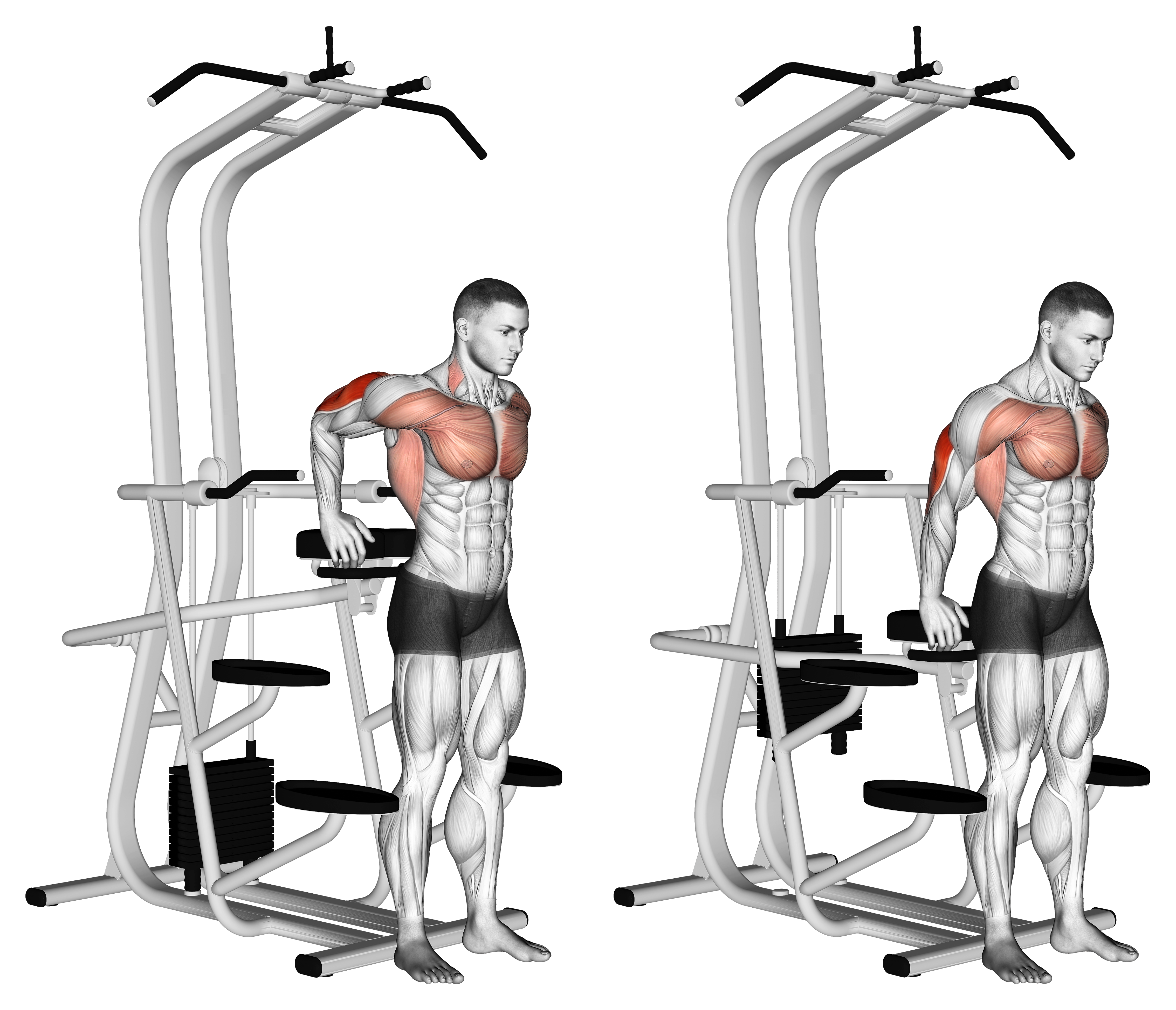 Assisted Standing Triceps Dip