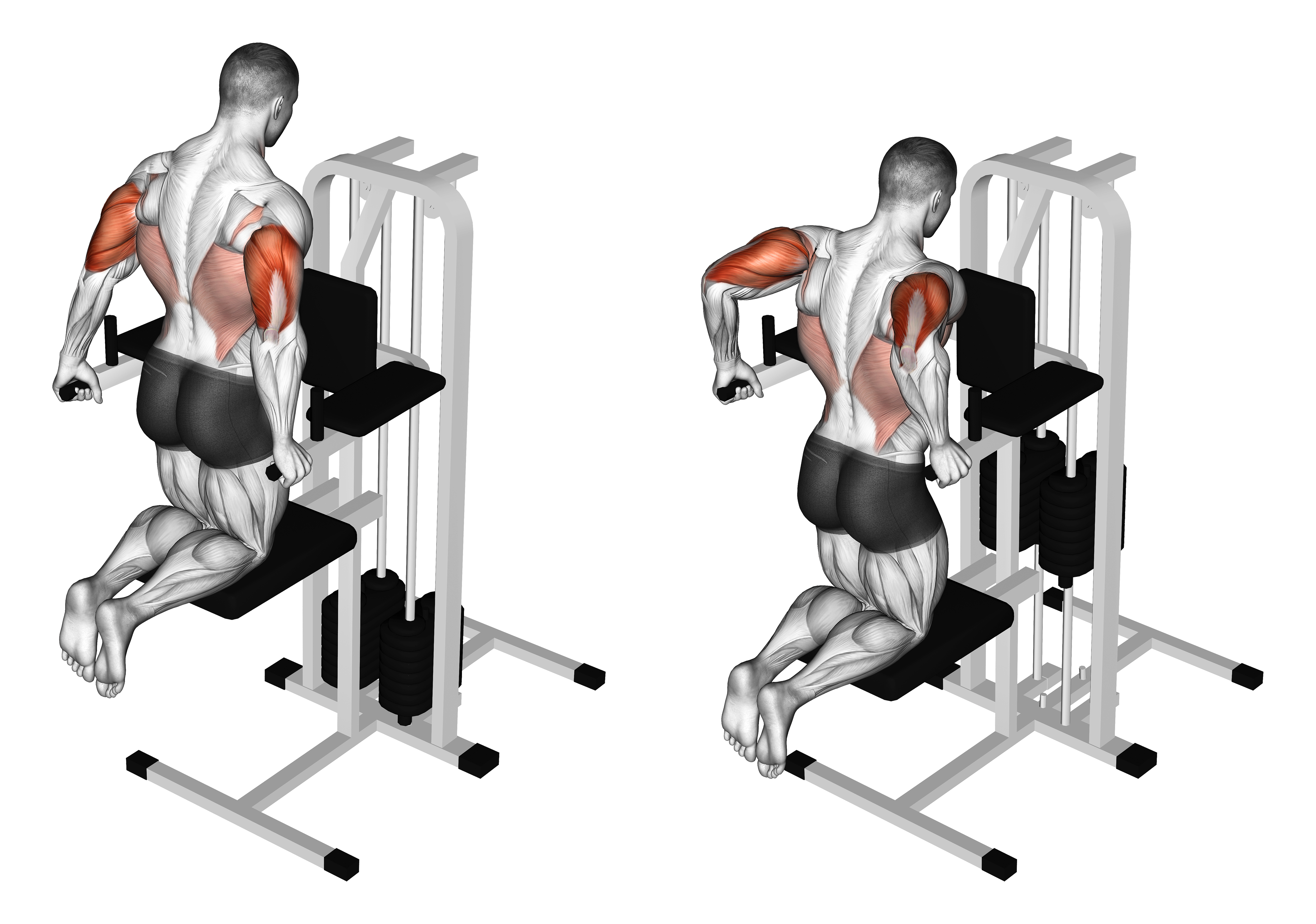 Assisted Triceps Dip Kneeling