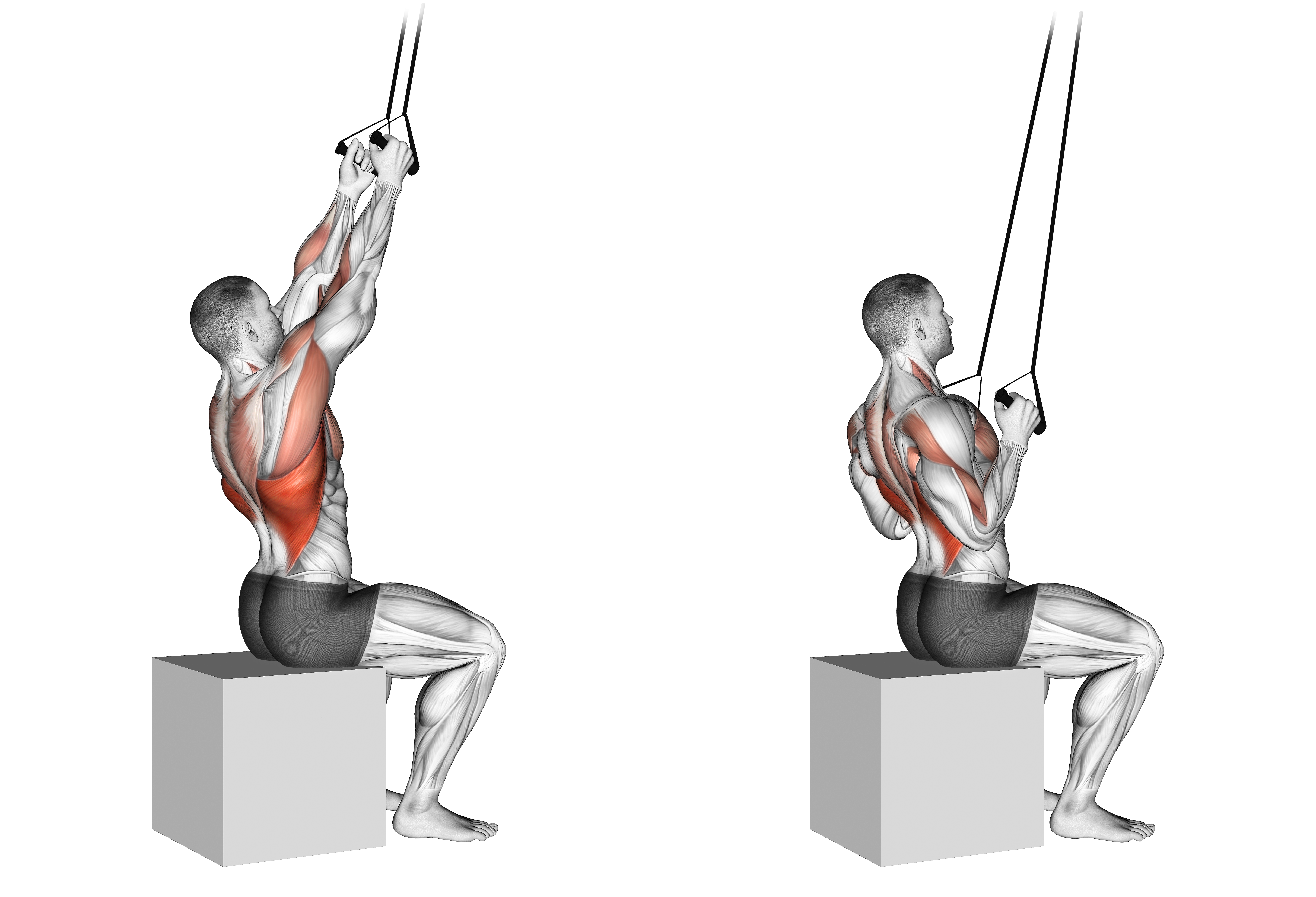 Band Fixed Back Close Grip Pulldown