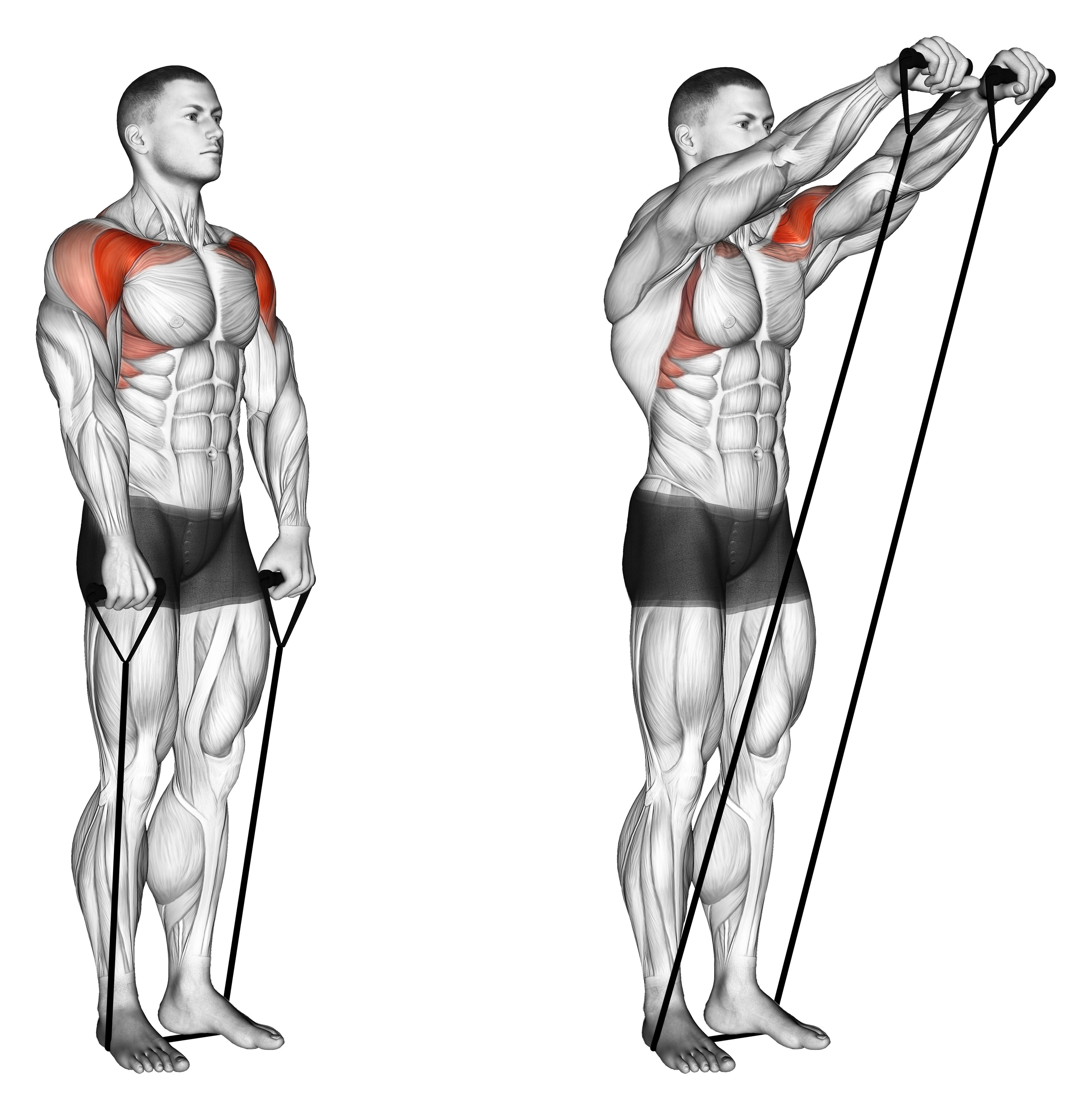Band Front Raise