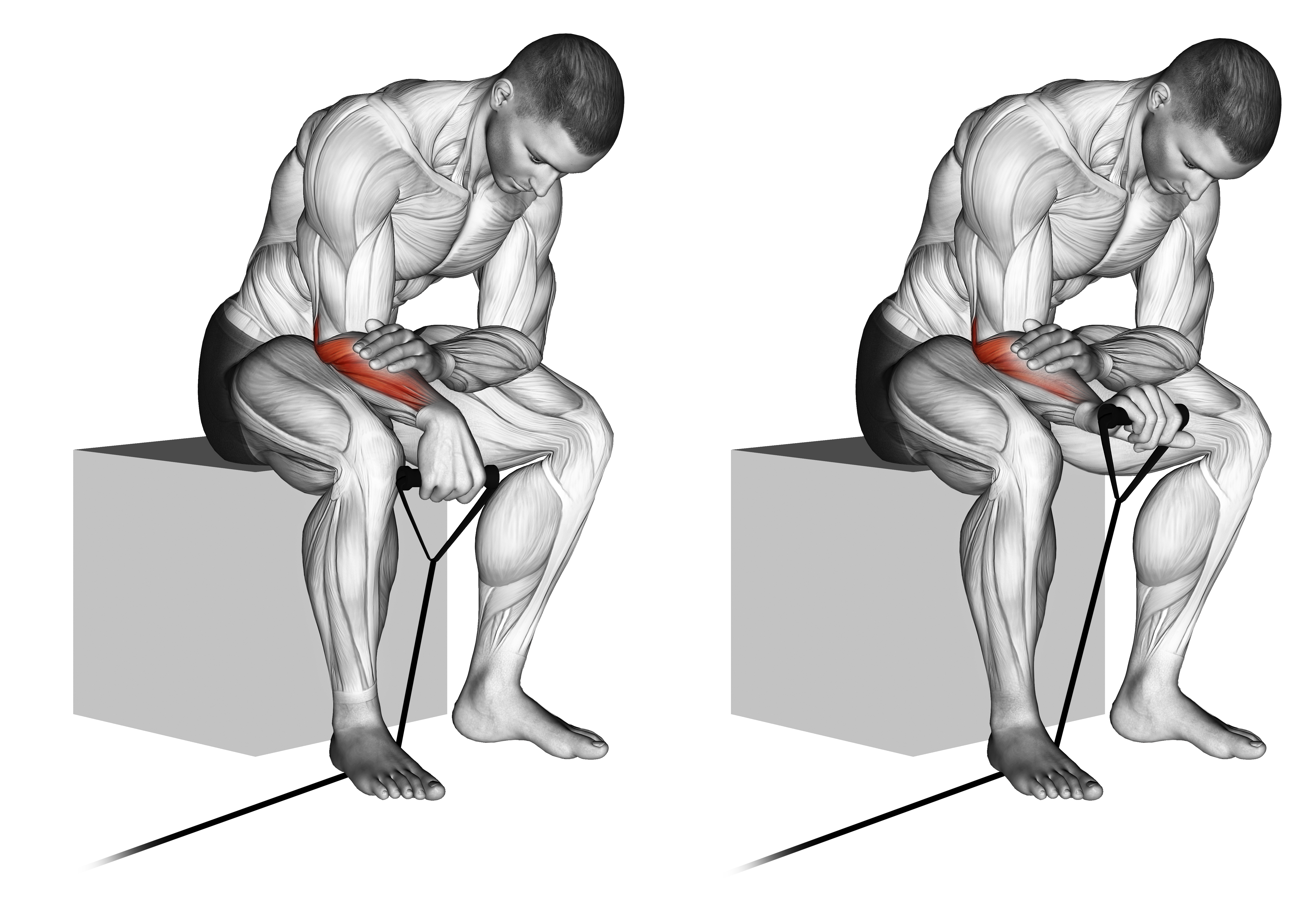 Band Reverse Wrist Curl
