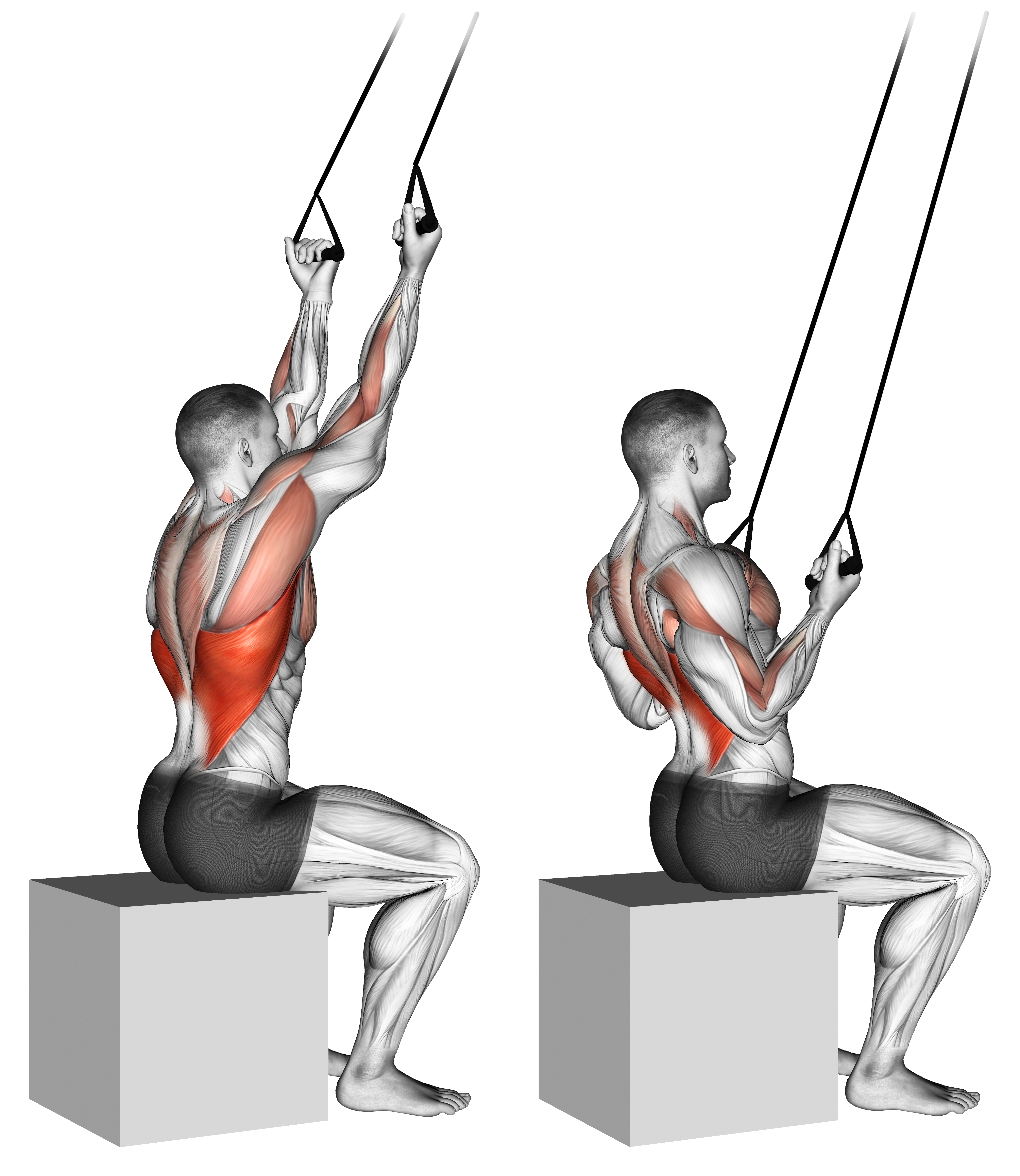 Band Underhand Pulldown