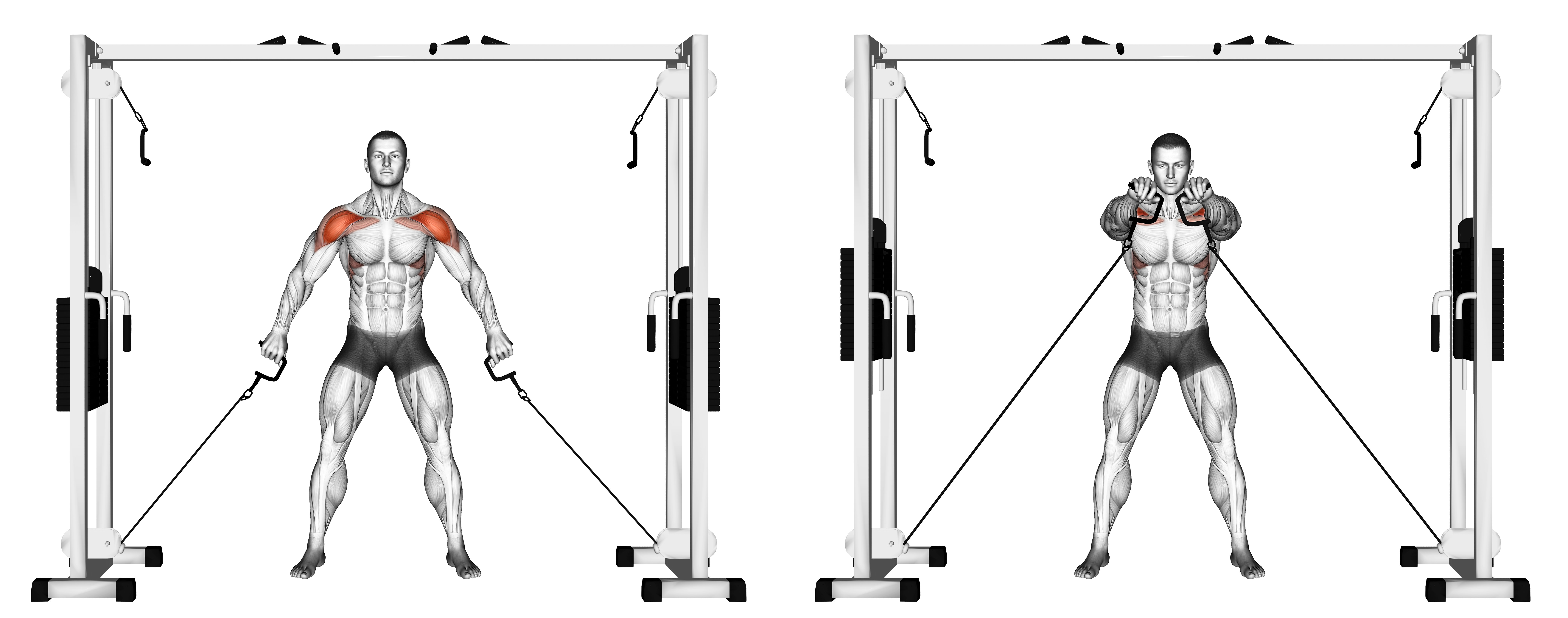 Cable Front Shoulder Raise