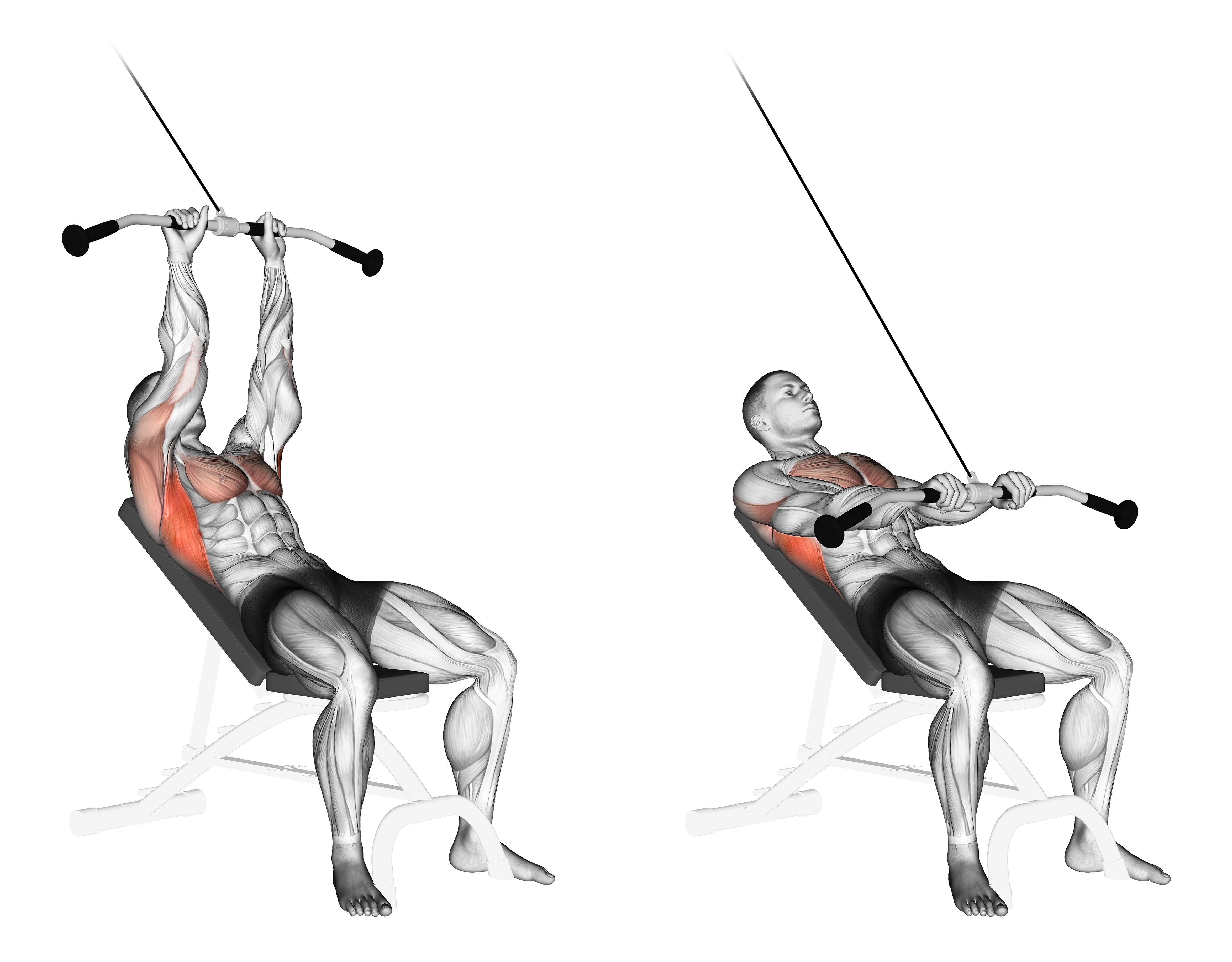Cable Incline Pushdown