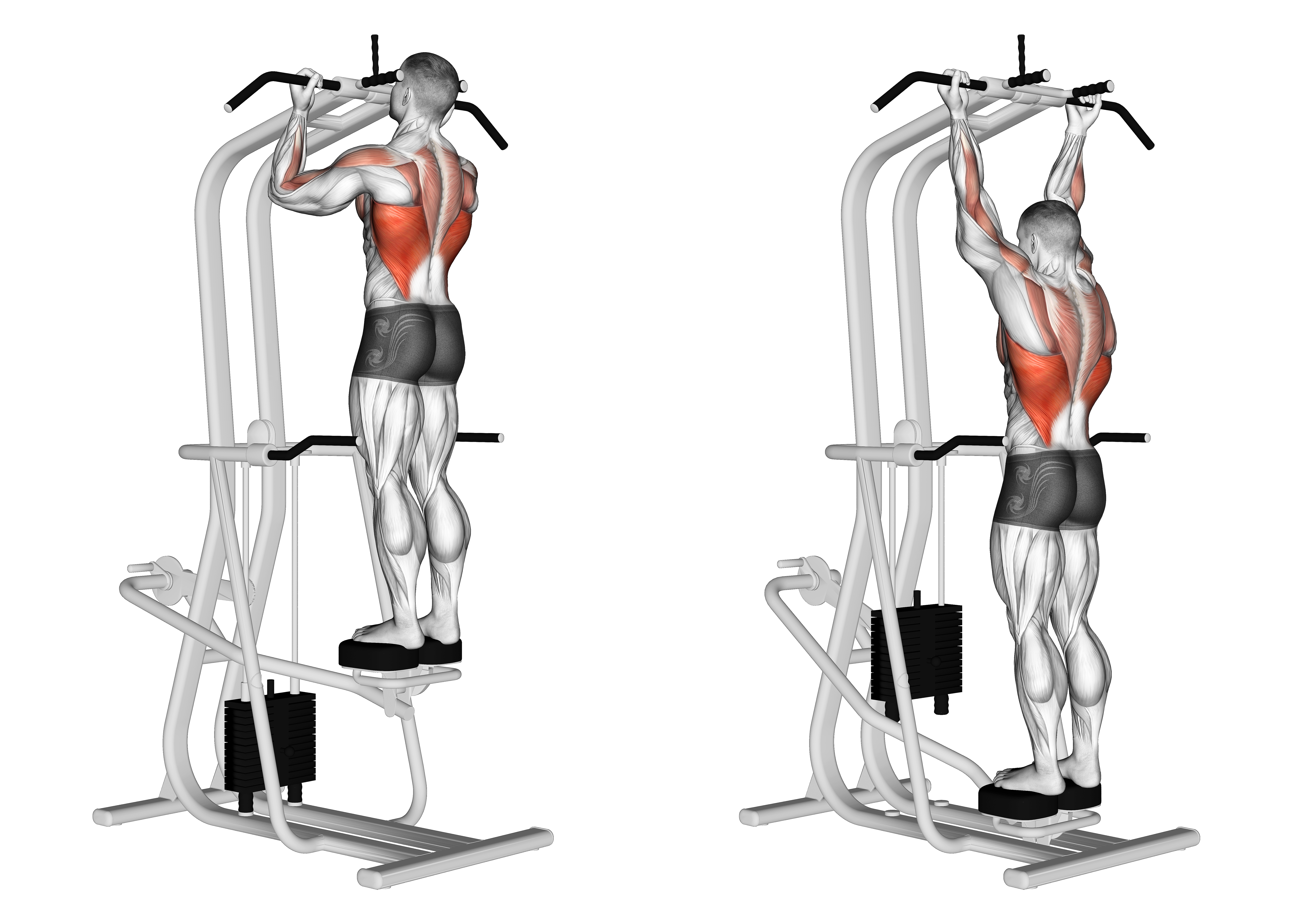Lever Assisted Standing Chin Up