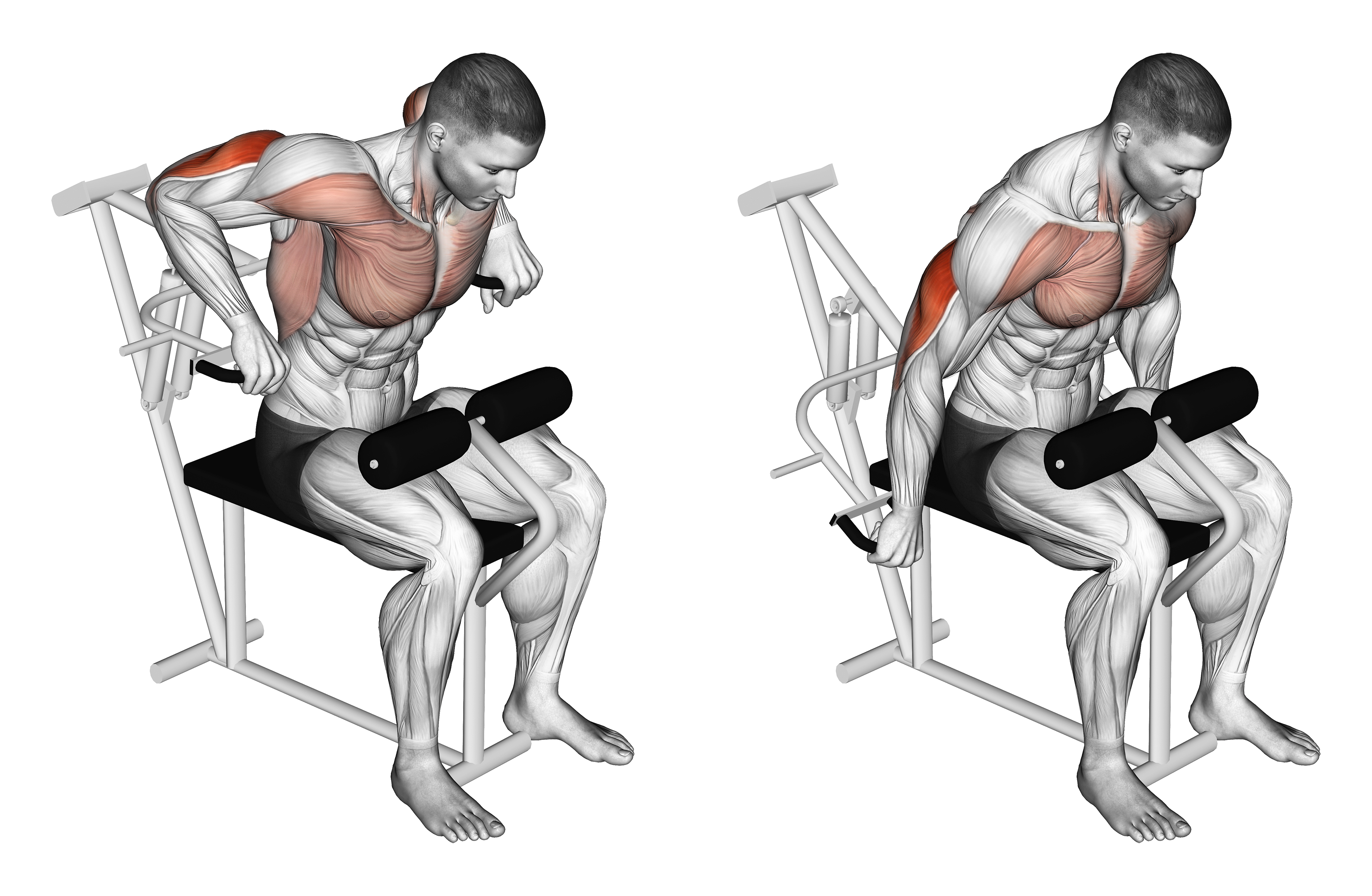 Lever Overhand Triceps Dip