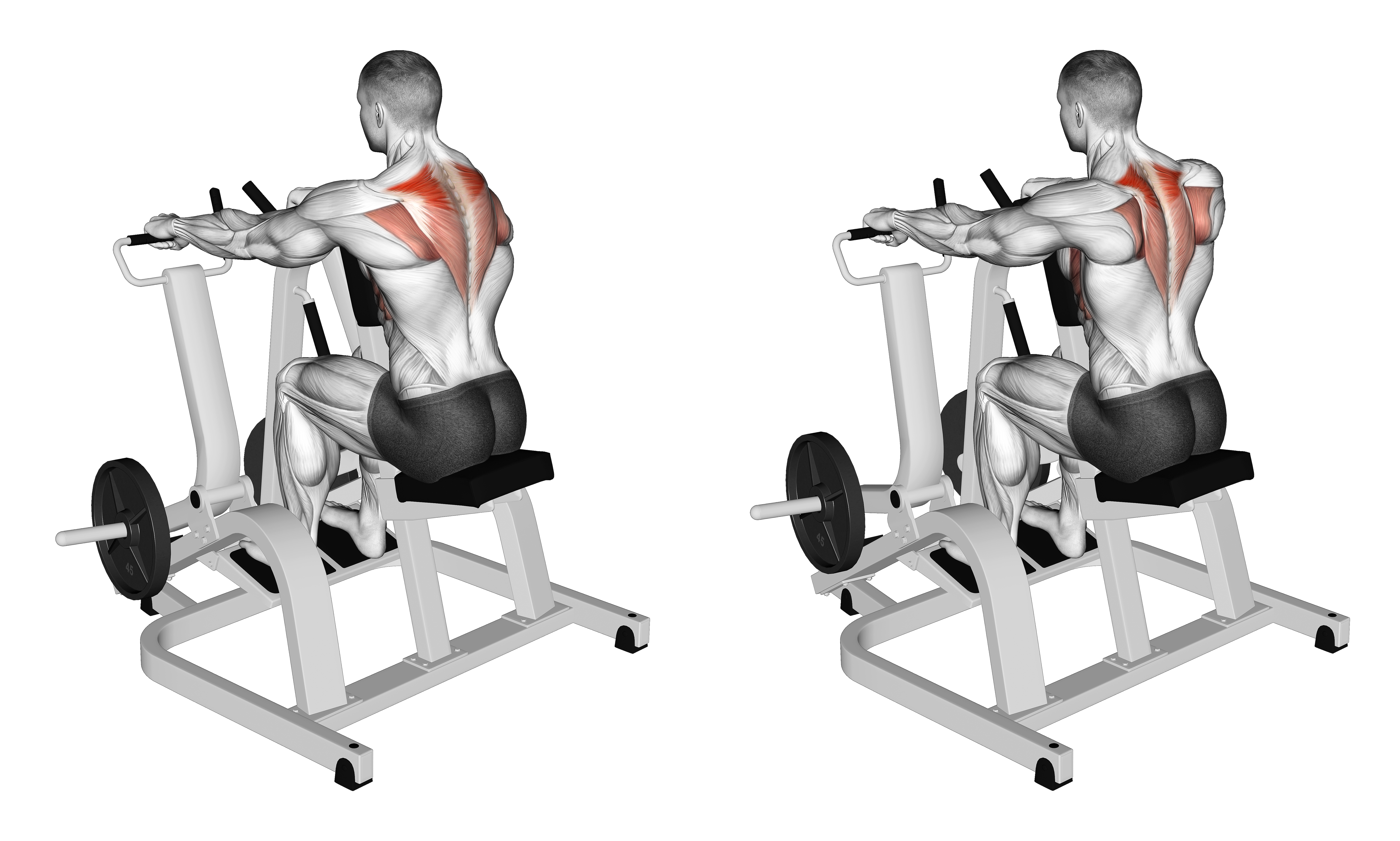 Lever Pronated Grip Seated Scapular Retraction Shrug (plate Loaded)
