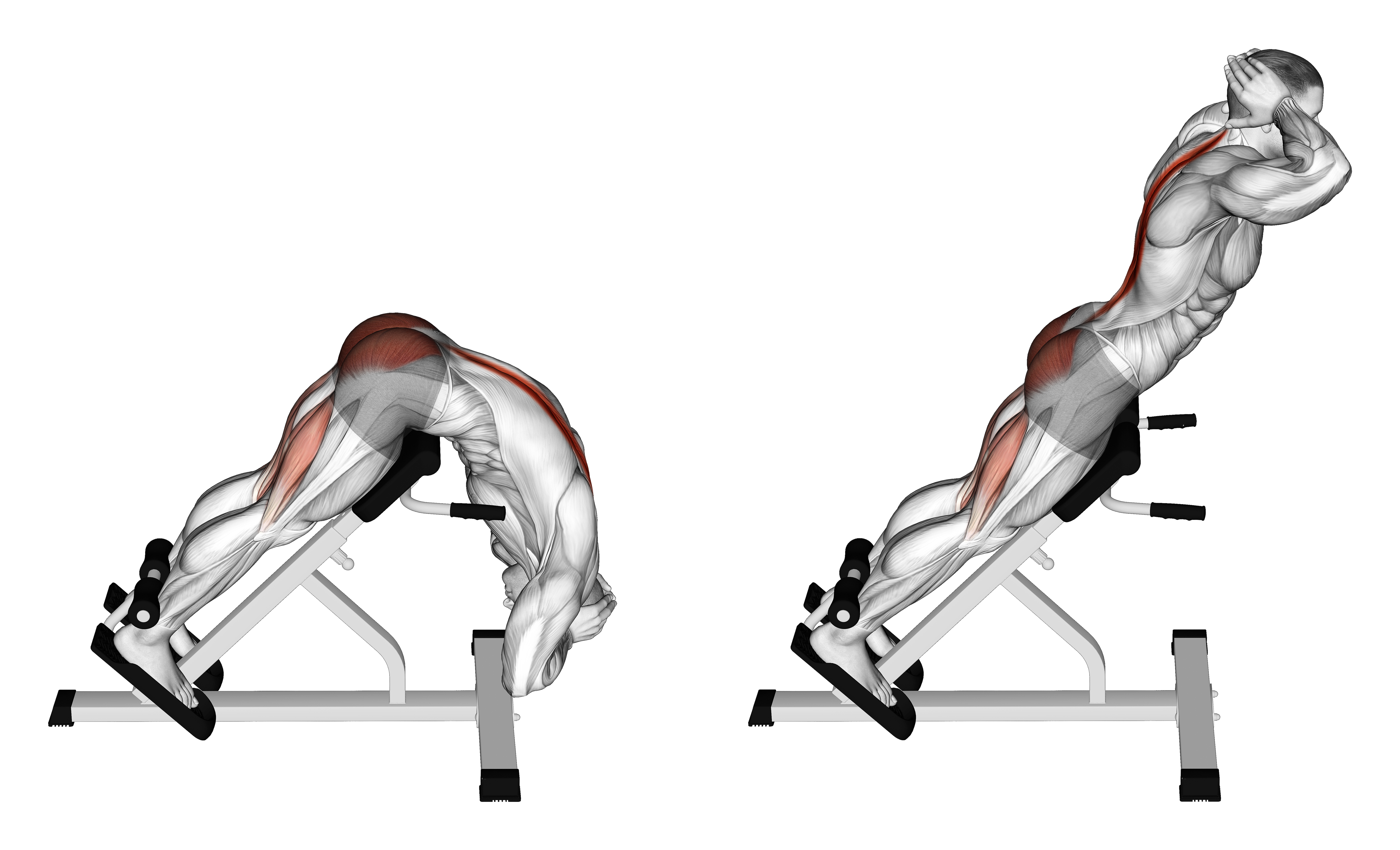 Hyperextension